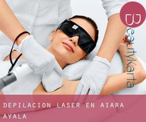 Depilación laser en Aiara / Ayala