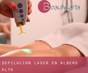 Depilación laser en Albero Alto