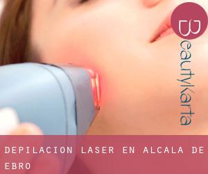 Depilación laser en Alcalá de Ebro