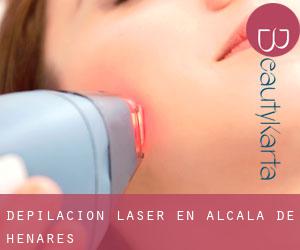 Depilación laser en Alcalá de Henares
