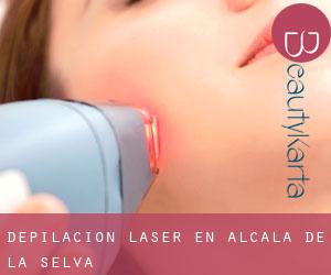 Depilación laser en Alcalá de la Selva