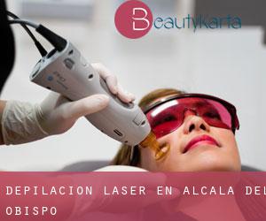 Depilación laser en Alcalá del Obispo