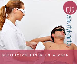 Depilación laser en Alcoba