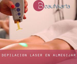 Depilación laser en Almegíjar