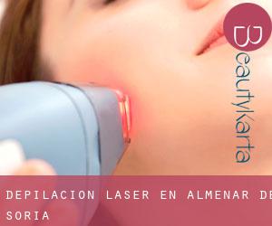 Depilación laser en Almenar de Soria
