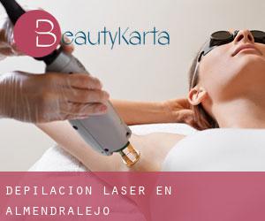 Depilación laser en Almendralejo