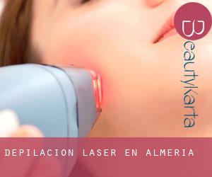 Depilación laser en Almería