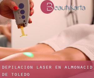 Depilación laser en Almonacid de Toledo