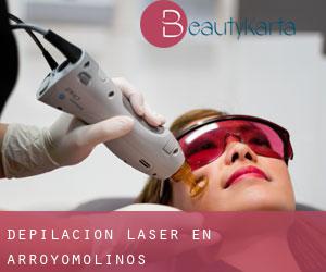 Depilación laser en Arroyomolinos