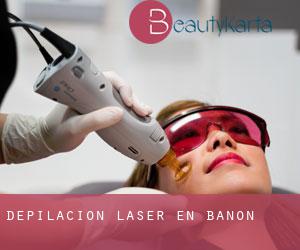 Depilación laser en Bañón