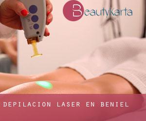 Depilación laser en Beniel