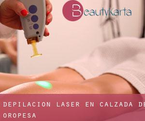 Depilación laser en Calzada de Oropesa