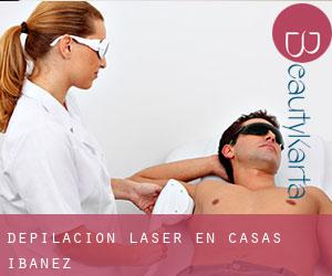 Depilación laser en Casas Ibáñez