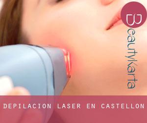 Depilación laser en Castellón Depilación laser en Castellón