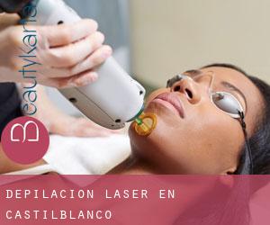 Depilación laser en Castilblanco