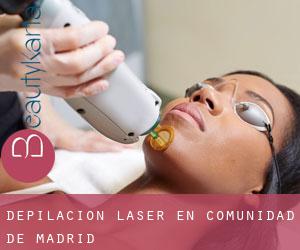 Depilación laser en Comunidad de Madrid