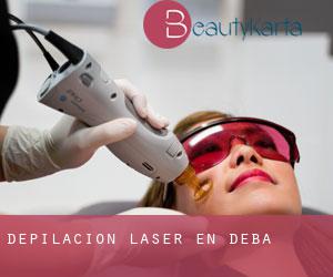 Depilación laser en Deba