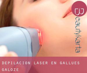 Depilación laser en Gallués / Galoze