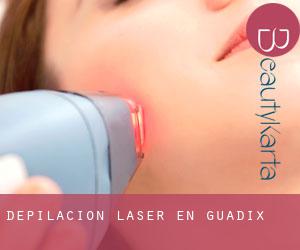 Depilación laser en Guadix