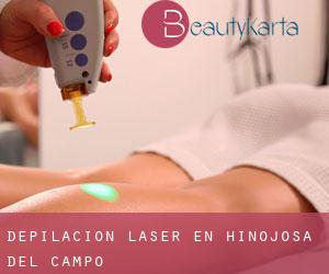 Depilación laser en Hinojosa del Campo