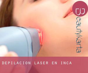 Depilación laser en Inca