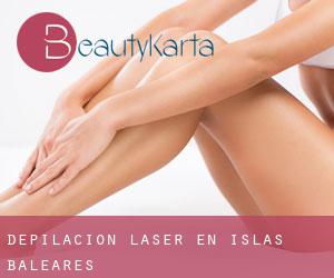 Depilación laser en Islas Baleares