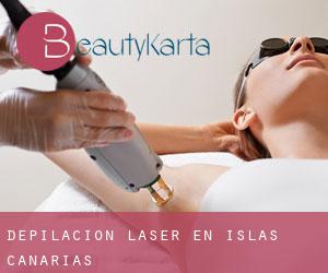 Depilación laser en Islas Canarias