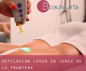 Depilación laser en Jerez de la Frontera