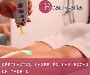 Depilación laser en Las Rozas de Madrid