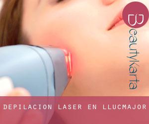 Depilación laser en Llucmajor