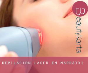 Depilación laser en Marratxí