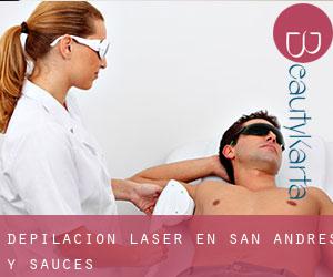 Depilación laser en San Andrés Y Sauces