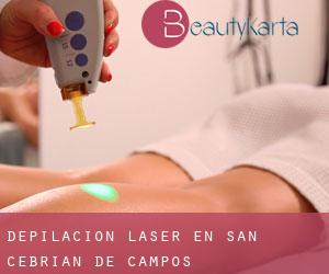 Depilación laser en San Cebrián de Campos