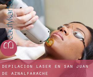 Depilación laser en San Juan de Aznalfarache