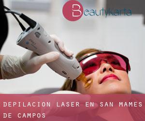 Depilación laser en San Mamés de Campos
