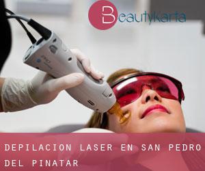 Depilación laser en San Pedro del Pinatar