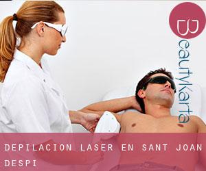 Depilación laser en Sant Joan Despí