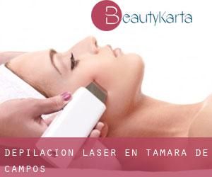 Depilación laser en Támara de Campos