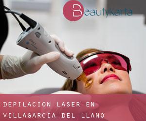 Depilación laser en Villagarcía del Llano