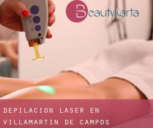 Depilación laser en Villamartín de Campos