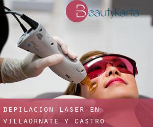 Depilación laser en Villaornate y Castro