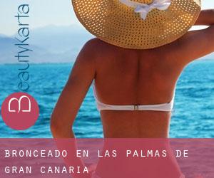 Bronceado en Las Palmas de Gran Canaria Bronceado en Las Palmas de Gran Canaria