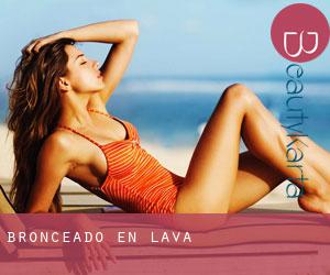 Bronceado en Álava Bronceado en Álava