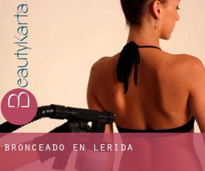 Bronceado en Lérida Bronceado en Lérida