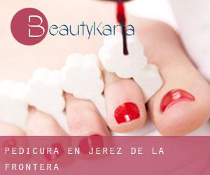 Pedicura en Jerez de la Frontera Pedicura en Jerez de la Frontera